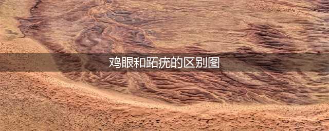 鸡眼、跖疣，傻傻分不清，七招教您正确区分！(鸡眼和跖疣的区别图)